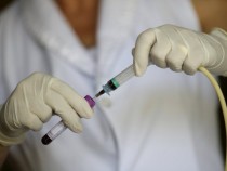 В Нью-Йорке родился первый ребенок с вирусом Зика