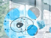Ученые разработали новый способ диагностики шизофрении