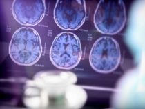 Белок, связанный с болезнью Альцгеймера, контролируется циркадным циклом