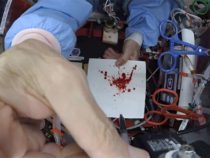CSI в космосе: анализ пятен крови в условиях микрогравитации